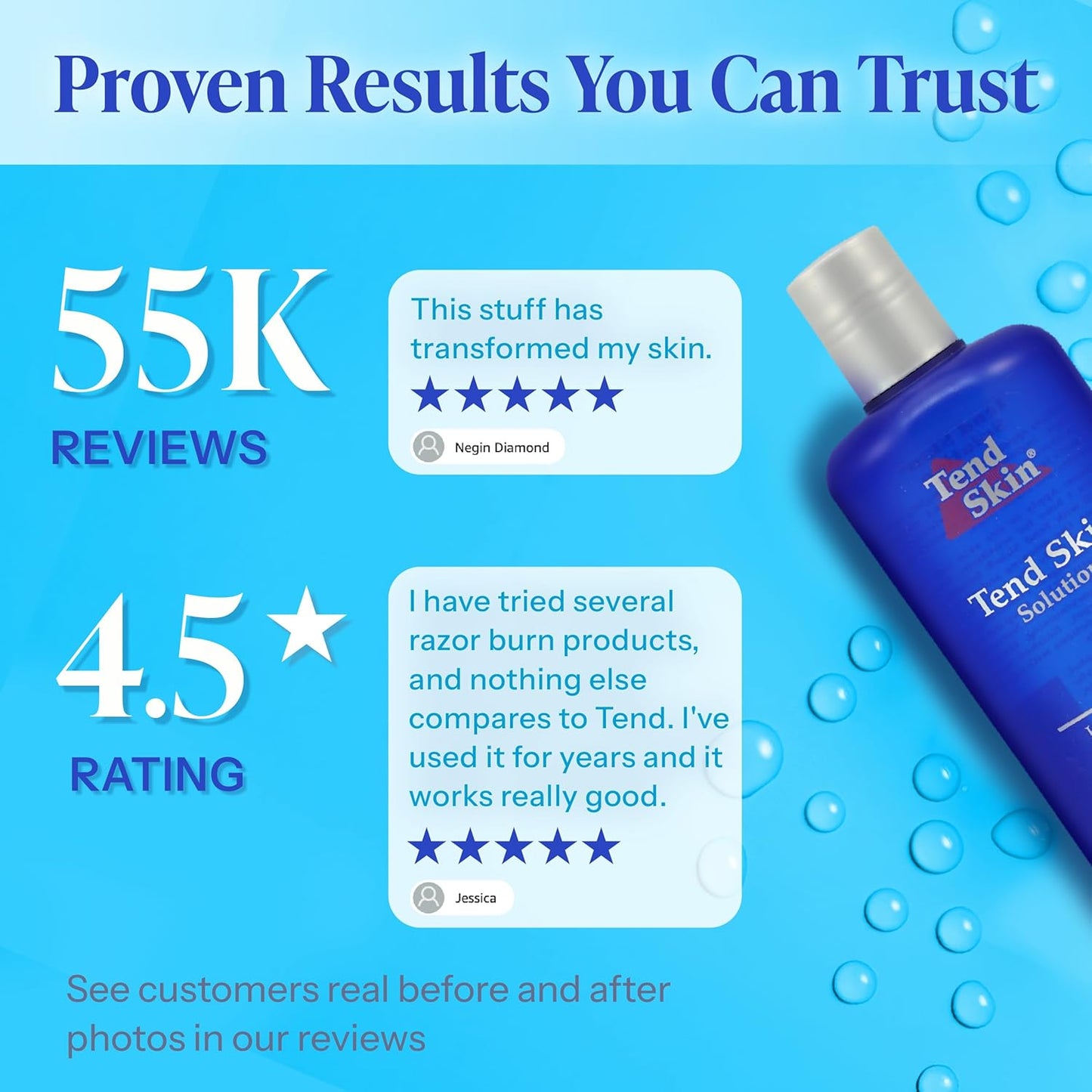 "Say Goodbye to Razor Bumps and Ingrown Hair with Our Skin Care Miracle, 8 Fl Oz Bottle"